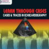 Learn Through Cases Traces in Echocardiography Dr Haseeb Raza jumabazar -