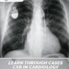 Learn Through Cases CXR In cardiology By Dr Haseeb Raza jumabazar -